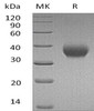Human IL-2RB/CD122 Recombinant Protein (RPES1171)