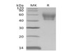 Mouse IL1R2/CD121b Recombinant Protein (RPES1175)