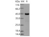 Human PRL-2/PTP4A2 Recombinant Protein (GST Tag) (RPES1181)