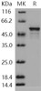 Human DOT1L/KMT4 Recombinant Protein (RPES1182)