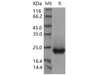 Mouse Frizzled0/FZD10 Recombinant Protein (His Tag) (RPES1186)
