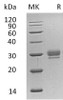 Human CTHRC1 Recombinant Protein (RPES1188)