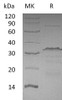 Human CTCF Recombinant Protein (RPES1191)