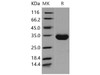 Human EPO Receptor/EPOR Recombinant Protein (His Tag) (Active) (RPES1201)