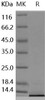 Human CCL22/MDC Recombinant Protein (RPES1202)