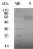 Human IL2RG/CD132 Recombinant Protein (RPES1208)