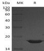 Human YY1 Recombinant Protein (RPES1210)