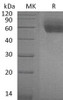 Mouse IL1RL1/ST2 Recombinant Protein (RPES1211)