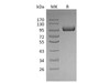 Mouse LRIG1 Recombinant Protein (RPES1215)