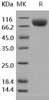Human CSF1R/CD115 Recombinant Protein (aa 1-512, His Tag) (Active) (RPES1219)