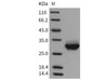 Rat CRP/C-Reactive Recombinant Protein (RPES1220)