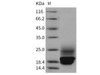 Rat Cystatin C/CST3 Recombinant Protein (RPES1235)