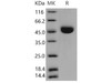 Mouse Cathepsin E/CTSE Recombinant Protein (RPES1236)