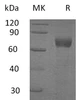 Human IL-20RA/IL-20R1 Recombinant Protein (RPES1240)