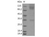 Mouse CD172a/SIRPA Recombinant Protein (Fc Tag) (Active) (RPES1242)