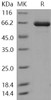 Human TLK2/PKU-ALPHA Recombinant Protein (His&GST Tag) (RPES1248)