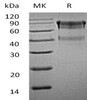 Mouse IL15RA/CD215 Recombinant Protein (RPES1261)