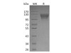 Human LEPR/CD295 Recombinant Protein (RPES1265)