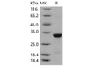 Human Beta-amyloid 40/Beta-APP40 Recombinant Protein (His&GST Tag) (Active) (RPES1270)