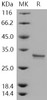 Human CUTC/CGI-32 Recombinant Protein (His Tag) (RPES1274)