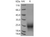 Mouse TIGIT Recombinant Protein (His Tag) (Active) (RPES1279)