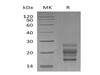 Mouse IL7A Recombinant Protein (RPES1280)