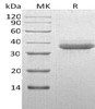 Human Chymotrypsin C Recombinant Protein (RPES1292)
