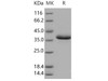 Human EGF Recombinant Protein (RPES1293)