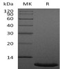 Human CXCL12/SDF Recombinant Protein (RPES1294)
