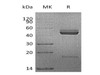 Mouse IL-23 Recombinant Protein (RPES1303)