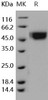 Human ILR9/IL1RAPL2 Recombinant Protein (RPES1324)