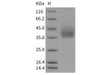 Rat Growth Hormone Receptor/GHR Recombinant Protein (His Tag) (Active) (RPES1325)
