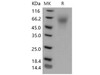 Mouse LYPD3 Recombinant Protein (His Tag) (Active) (RPES1326)