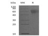Mouse IL-2RG/CD132 Recombinant Protein (RPES1339)
