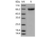 Mouse Acetylcholinesterase/ACHE Recombinant Protein (His Tag) (Active) (RPES1346)