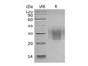 Human PD/PDCD1 Recombinant Protein (RPES1350)