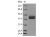 Mouse Kallikrein 11/KLK11 Recombinant Protein (His Tag) (RPES1352)