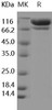 C2/Complement Component 2 Recombinant Protein (RPES1363)