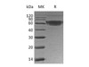 Human PD/PDCD1 Recombinant Protein (RPES1369)