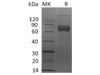 Human IL4RA/CD124 Recombinant Protein (RPES1376)