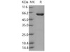 Human CSNK2A2/CK2A2 Recombinant Protein (His & GST Tag) (Active) (RPES1378)