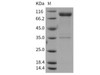 Rat IL1R1/CD121a Recombinant Protein (His & Fc Tag) (Active) (RPES1382)