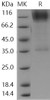 Human B3GNT2 Recombinant Protein (Fc Tag) (RPES1384)