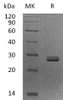 Human PDCD10/TFAR15 Recombinant Protein (RPES1388)
