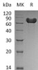 Human GOLPH2/GOLM1 Recombinant Protein (aa 40-401, His Tag) (RPES1398)