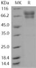 Human Coagulation Factor IX/F9 Recombinant Protein (His Tag) (Active) (RPES1399)