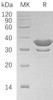 Human SULT2A1 Recombinant Protein (His Tag) (RPES1404)
