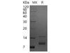 Human CXCL7/NAP-2 Recombinant Protein (RPES1406)