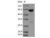 Mouse PTPN6/SH-PTP1 Recombinant Protein (aa 207-597, His & GST Tag) (Active) (RPES1430)