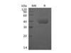 Human TEM8/ATR Recombinant Protein (RPES1435)
